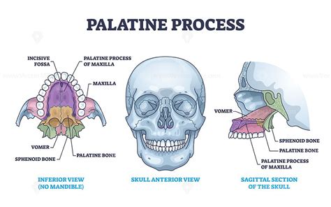 Palatine process section anatomy with maxilla structure outline diagram | Anatomy bones ...