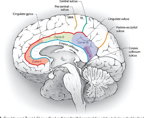 Figure 1 from Assessment of morbidity following resection of cingulate gyrus gliomas. Clinical ...