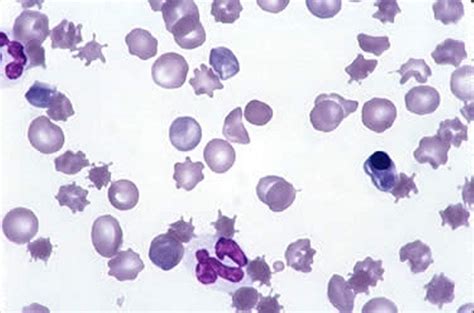 Image: Canine blood smear, regenerative anemia - MSD Veterinary Manual