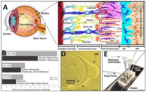 Cell replacement therapy to treat age-related retinal degeneration... | Download Scientific Diagram