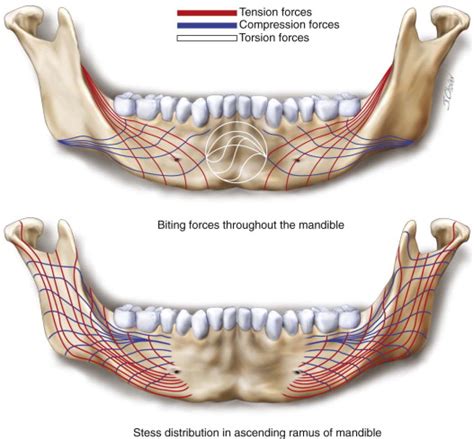 Principles and Biomechanics of Rigid Internal Fixation of the Mandible ...