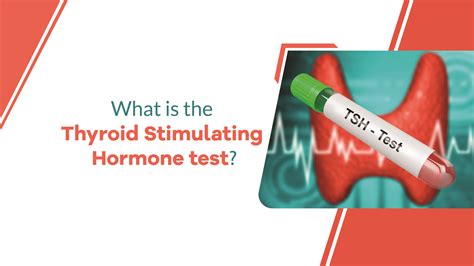 What is the Thyroid Stimulating Hormone Test?