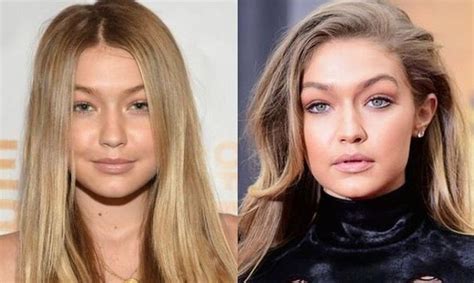 Gigi Hadid before after plastic surgery (24) | Celebrity plastic surgery online