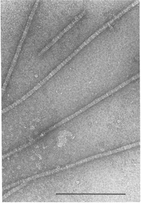 Structure of costal cartilage | Semantic Scholar