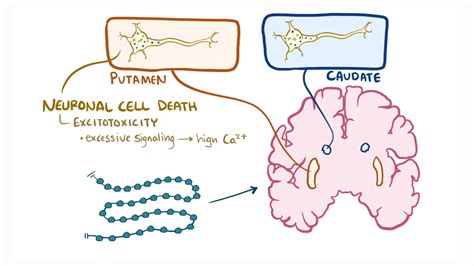 Huntington disease: Year of the Zebra: Video | Osmosis