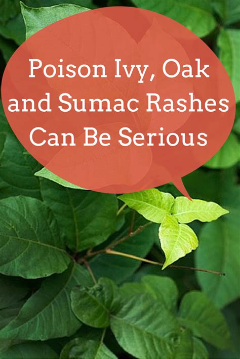 Poison Ivy, Oak and Sumac Rashes Can Be Serious | Sumac rash, Poison sumac rash, Sumac