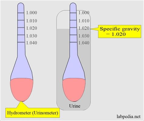 Urine Specific Gravity and Its Significance - Labpedia.net