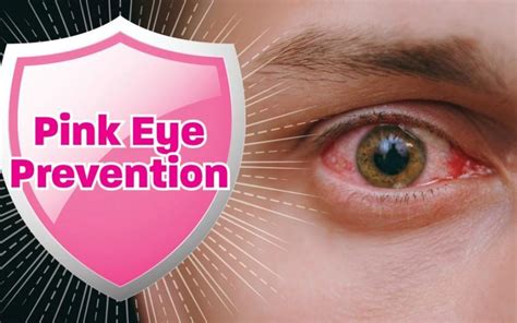 Pink Eye Prevention: Inglewood Optometric Center: Optometry