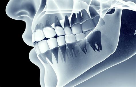 CBCT Scan - DrBK Cosmetic Dentist & Aesthetics Clinic in Reading