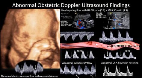 Fetal ultrasound heart rate | Ultrasound, Obstetric ultrasound ...