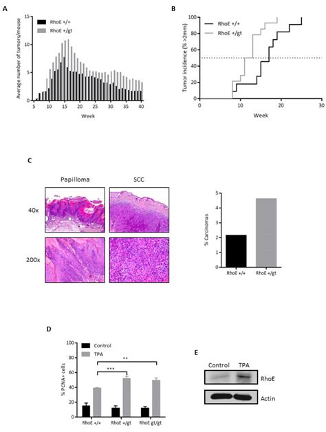 RhoE is required for contact inhibition and negatively regulates tumor initiation and ...