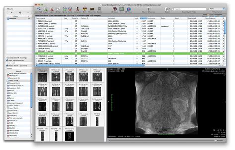 Osirix Download For Pc - abcstorm