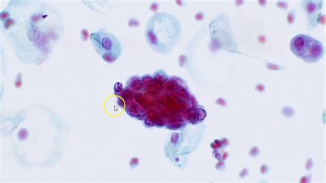 Cervical Cytology