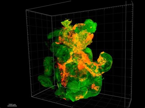 Nanoparticles for optimized cancer therapy - Innovative method holds promise for more targeted ...