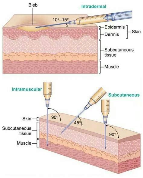 Needle attack angles | Nurse, Nursing school studying, Nursing school tips