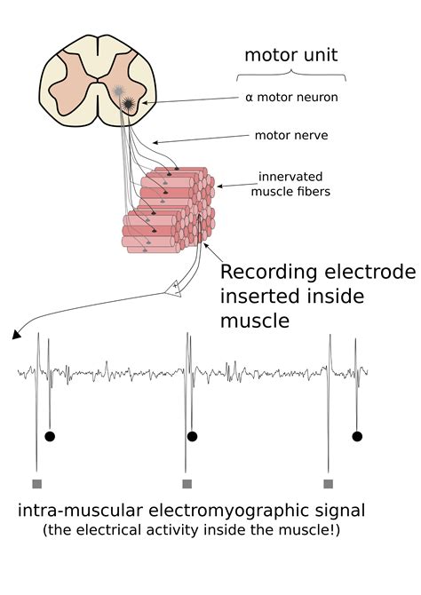 [DIAGRAM] Diagram Of Motor Unit - MYDIAGRAM.ONLINE