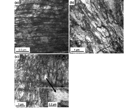 Microstructure of (a) pearlite, (b) bainite, and (c) martensite after... | Download Scientific ...