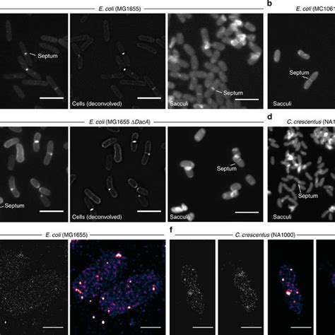 (PDF) Cell wall elongation mode in Gram-negative bacteria is determined by peptidoglycan ...