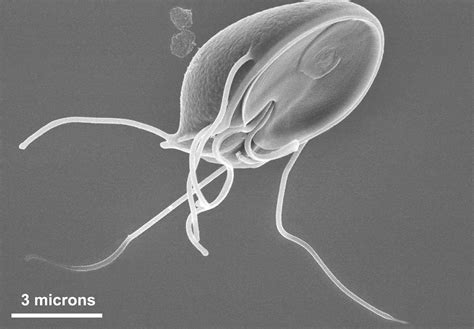 Giardia in the Intestine: Parasite Facts and Giardiasis Disease - Owlcation