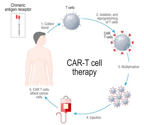 Cancer Immunotherapy Clinical Trials | UCSF Helen Diller Family Comprehensive Cancer Center