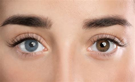 How to Change Eye Color Naturally? Is it Even Possible? - Healthwire