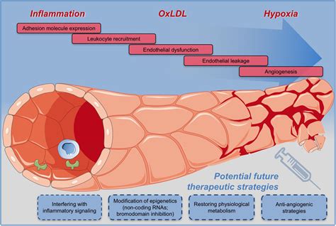 Frontiers | Vasa Vasorum Angiogenesis: Key Player in the Initiation and ...