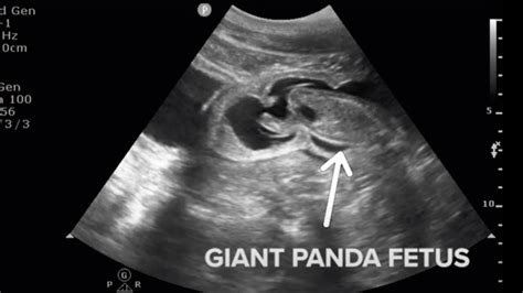 Baby Panda Seen ‘Kicking and Swimming’ on Mei Xiang’s Ultrasound, National Zoo Says – NBC Bay Area