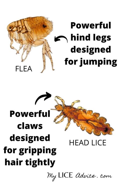 How Lice Spread. Do Lice Jump? Do Lice Fly or Have Wings?