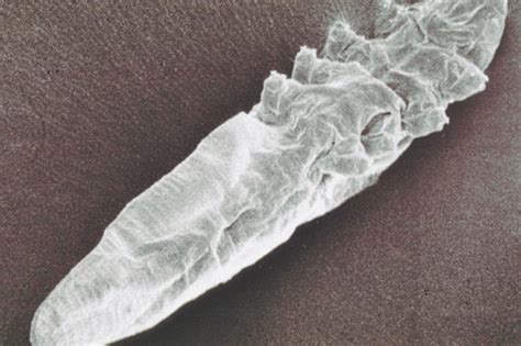 Demodex Mites Inside Nose