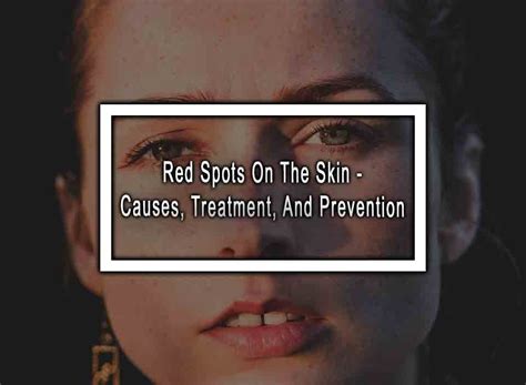 Red Spots On The Skin: Causes, Treatment, And Prevention