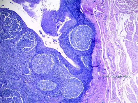 Palatine Tonsil Microscope Slide