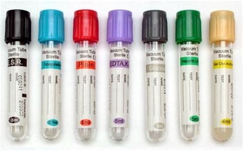 Common blood collection tubes, their additives and laboratory uses ...