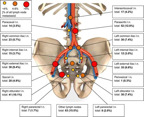 Internal Iliac Lymph Nodes