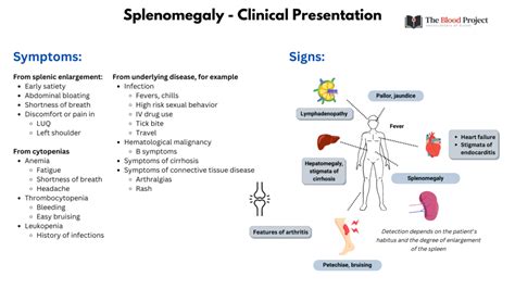 History and Physical Examination in Patient with Splenomegaly • The ...