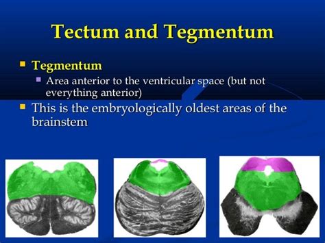 Lect -brainstem