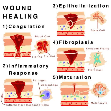 Skin Regeneration in Wound Healing: The Art of Self Preservation – SQ ...