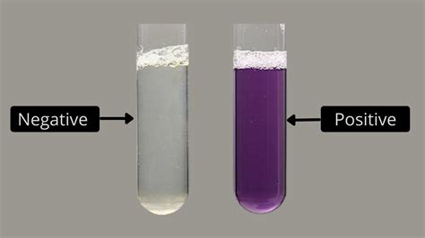 Biuret Test For Protein Principle, Procedure, Result, Application. - Biology Notes Online