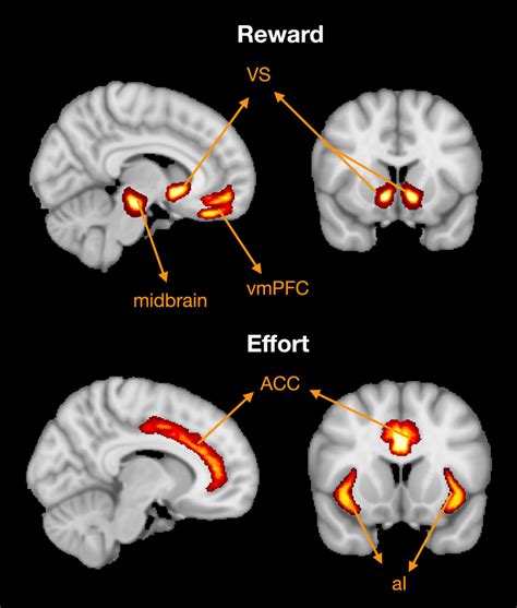 Brain regions associated with reward and effort processing. Based on a ...