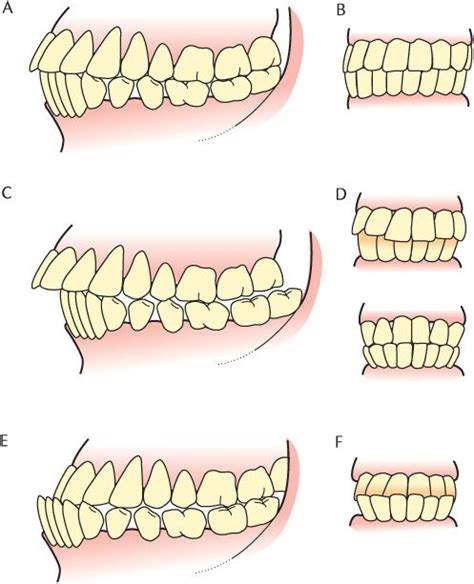 26 Mastication | Pocket Dentistry