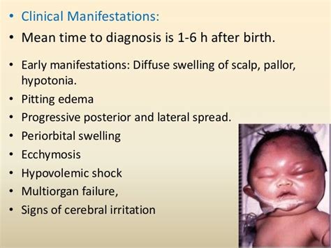 Subgaleal Hemorrhage Ultrasound