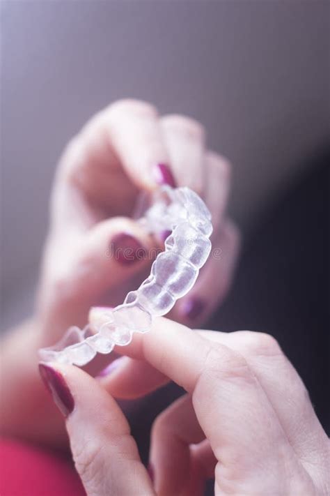 Clear Dental Teeth Retainers Stock Photo - Image of beauty, health ...