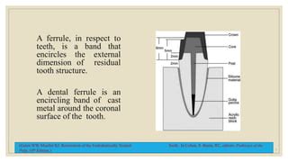 Ferrule effect | PPT