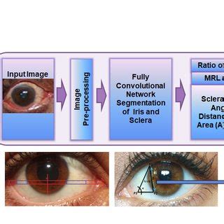 Eye pressure risk evaluation from frontal eye images. | Download ...