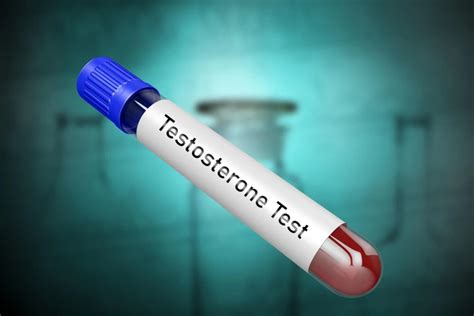 Testosterone Test Singapore: Friendly, Fast & Comprehensive