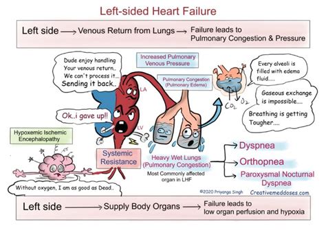 Heart Failure: Left sided VS Right sided - Creative Med Doses