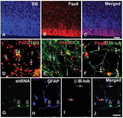 Figure 9 from Radial Glia Cells in the Developing Human Brain | Semantic Scholar