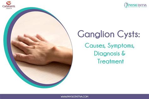 Ganglion Cysts: Causes, Symptoms, and Treatment