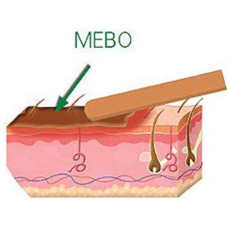 MEBO Burn Cream - Fast Healing for Wounds and Scars (30g) in Nepal at ...