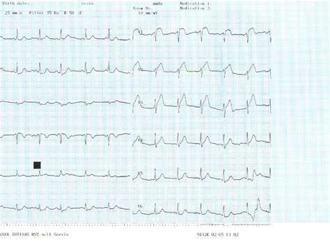 Figure 1 from The classical "R-on-T" phenomenon. | Semantic Scholar