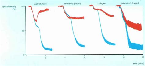 Platelet Function Testing: Light Transmission Aggregometry